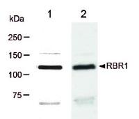 RBR1 | Retinoblastoma related protein in the group Antibodies Plant/Algal / DNA/RNA/Cell Cycle / Cell cycle at Agrisera AB (Antibodies for research) (AS11 1627)